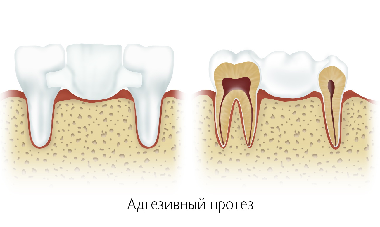 Модные стрижки до плеч: варианты, фото, укладка МЕДЕЛ Многопрофильная Клиника в Казани - Клиника современной