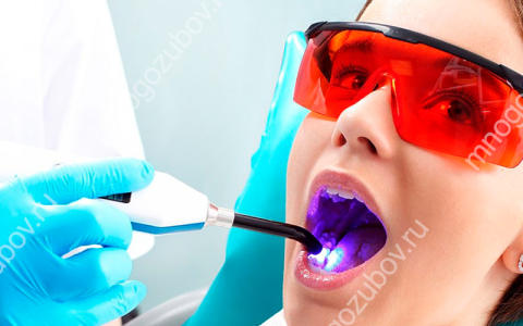 Лечение зубов лазером