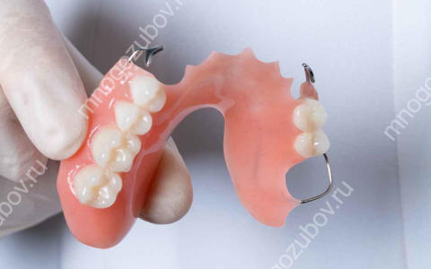 Есть ли гарантия на съемные зубные протезы?