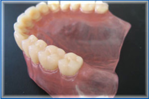 Фото: Капроновые протезы зубов