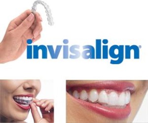Инвизилайн — прозрачные эстетические элайнеры на зубах