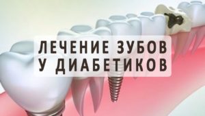 Имплантация зубов противопоказания сахарный диабет thumbnail