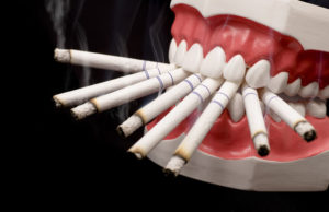 Фото: Сигареты и импланты