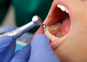 Противопоказания в стоматологии при сахарном диабете thumbnail