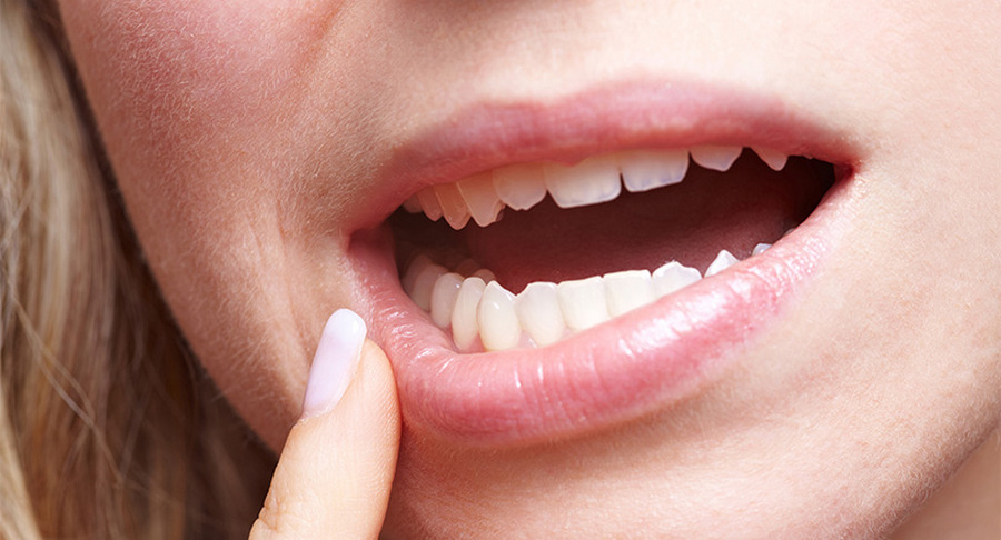 Причины обращения к стоматологу