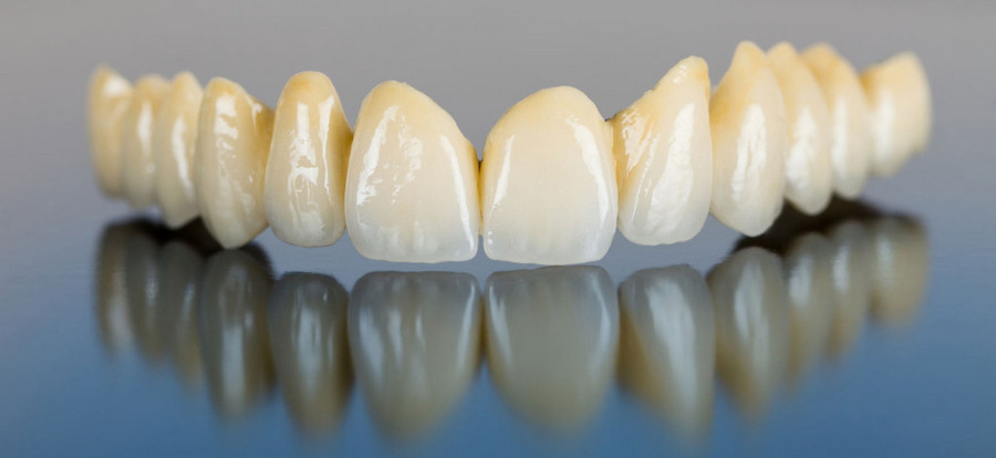 Может ли быть аллергия на зубы из металлокерамики thumbnail