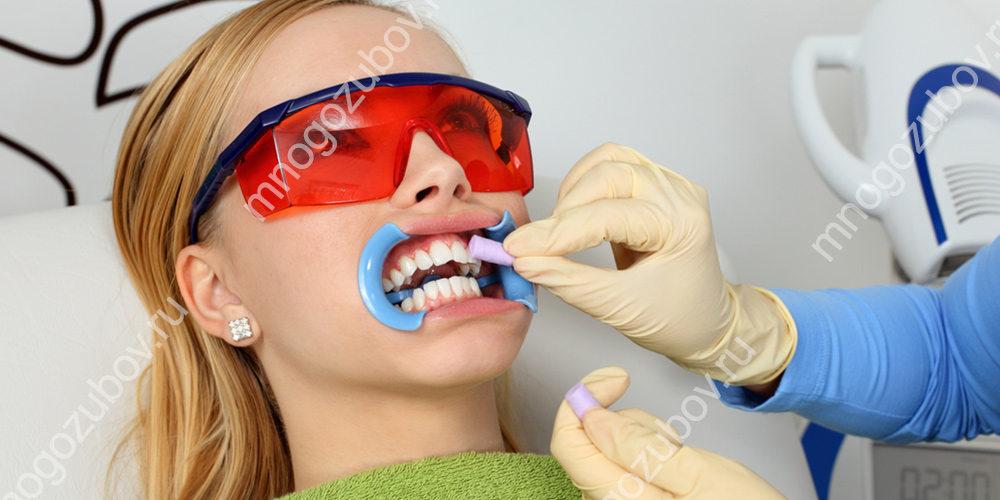 Болит зуб после шлифовки thumbnail